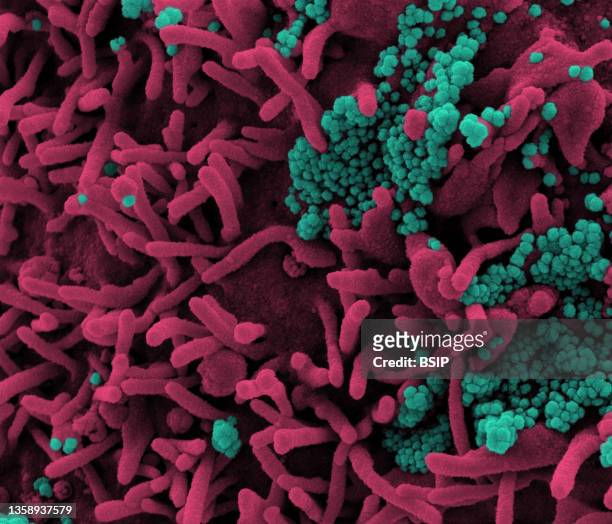 Colorized scanning electron micrograph of a cell infected with SARS-CoV-2 virus particles , isolated from a patient sample. Image captured at the...