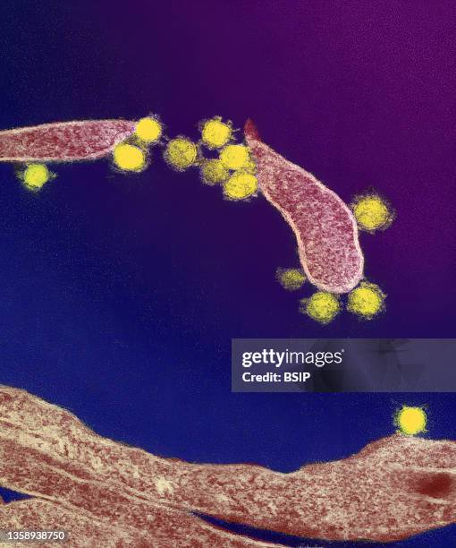 This transmission electron microscope image shows SARS-CoV-2 also known as 2019-nCoV, the virus that causes COVID-19. Virus particles are shown...