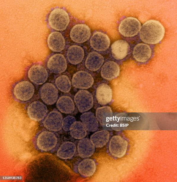 Transmission electron micrograph of a variant strain of SARS-CoV-2 virus particles , isolated from a patient sample and cultivated in cell culture....
