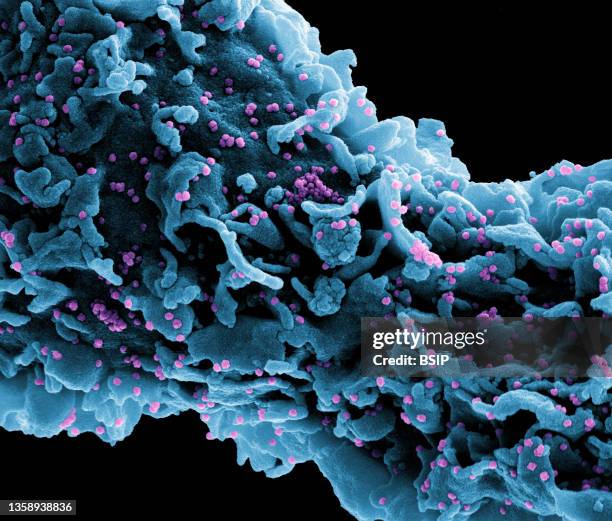 Colorized scanning electron micrograph of a cell infected with a variant strain of SARS-CoV-2 virus particles , isolated from a patient sample. Image...