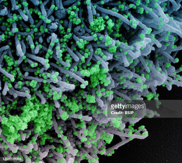 Colorized scanning electron micrograph of a cell infected with a variant strain of SARS-CoV-2 virus particles , isolated from a patient sample. Image...