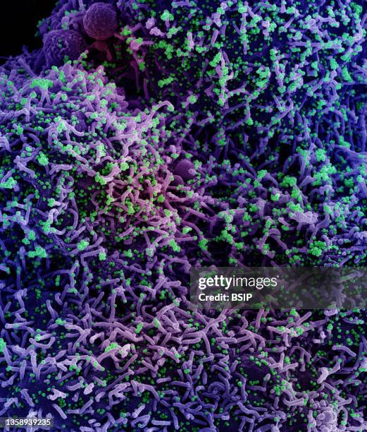 Scanning electron micrograph of a cell infected with a variant strain of SARS-CoV-2 virus particles .