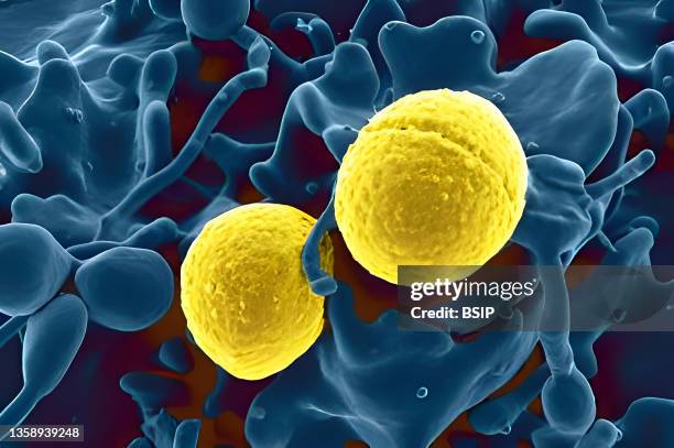 Scanning electron micrograph of Staphylococcus aureus bacteria outside a white blood cell .