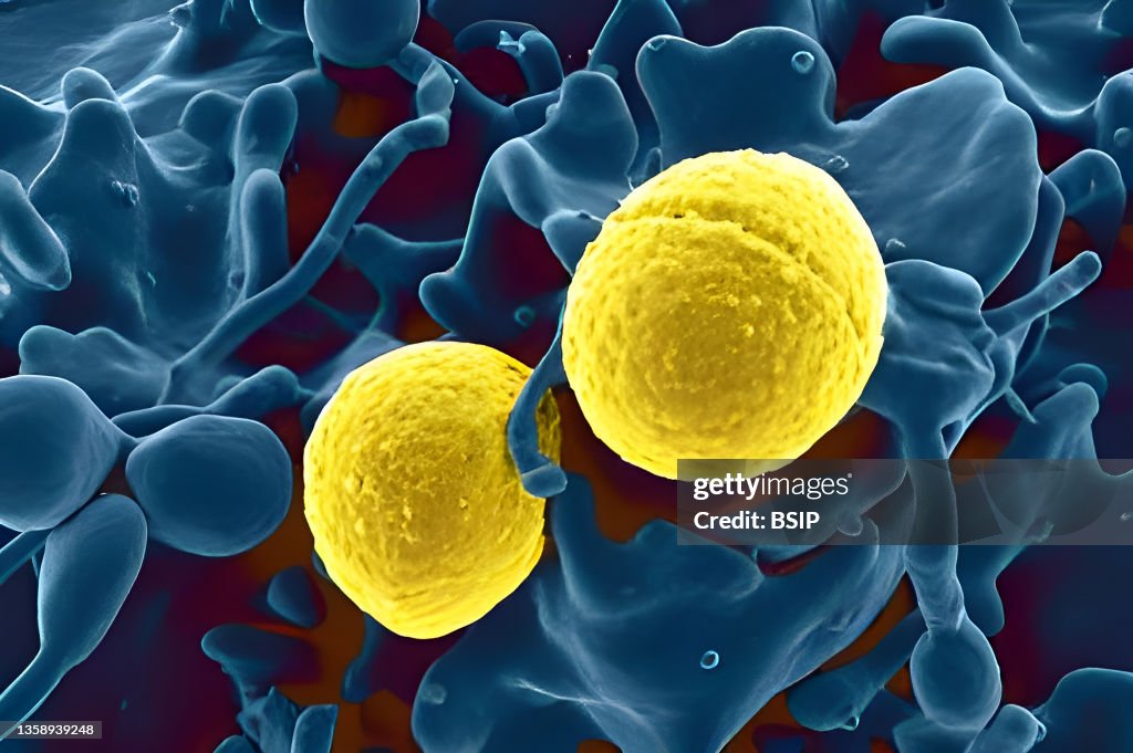 Staphylococcus aureus bacteria