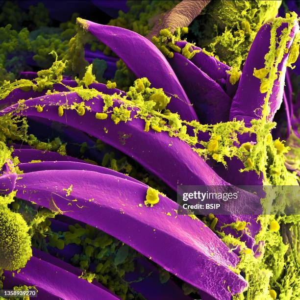 Scanning electron micrograph of Yersinia pestis, which causes bubonic plague, on proventricular spines of a Xenopsylla cheopis flea.