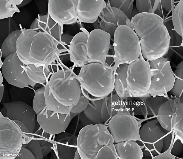 Phenotypic variants of Neisseria gonorrhoeae bacteria, scanning electron microscope image.