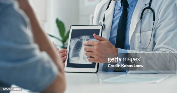 beschnittene aufnahme eines nicht erkennbaren arztes, der mit seiner patientin sitzt und ihre röntgenaufnahmen auf einem digitalen tablet zeigt - lunge krank stock-fotos und bilder
