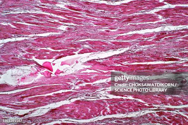 cardiac callosity, light micrograph - tissue anatomy stock pictures, royalty-free photos & images