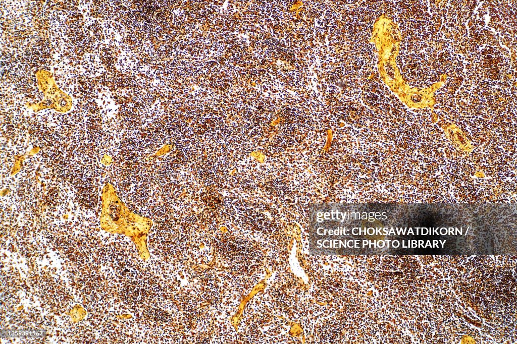 Reticular cell, light micrograph