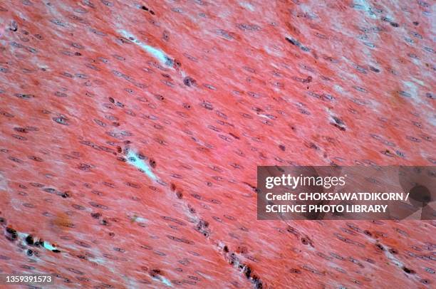 Michrograph 182 Light Micrograph Muscle Stock Photos, High-Res Pictures, and Images ...