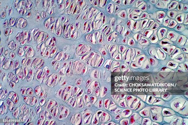 human cartilage bone, light micrograph - micrografia científica imagens e fotografias de stock