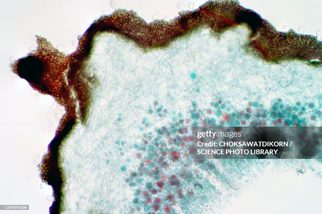 Lichen and fungi, light micrograph