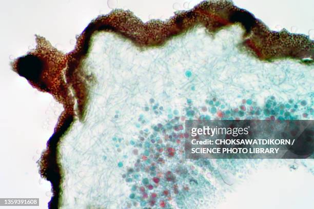 lichen and fungi, light micrograph - histology 個照片及圖片檔