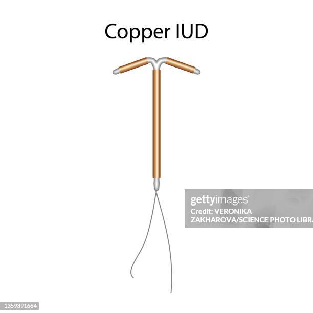 copper intrauterine devices, illustration - contraceptive stock-grafiken, -clipart, -cartoons und -symbole