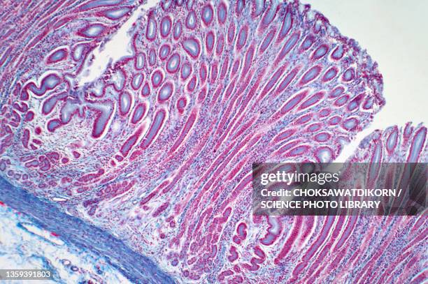 colon biopsy, light micrograph - microscopie optique photos et images de collection