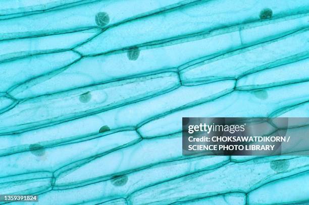 plant cell, light micrograph - zellmembran stock-fotos und bilder