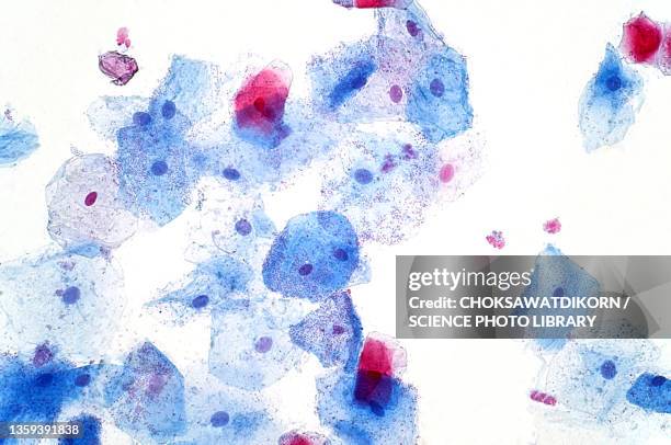 buccal mucosa cell, light micrograph - darmschleimhaut stock-fotos und bilder