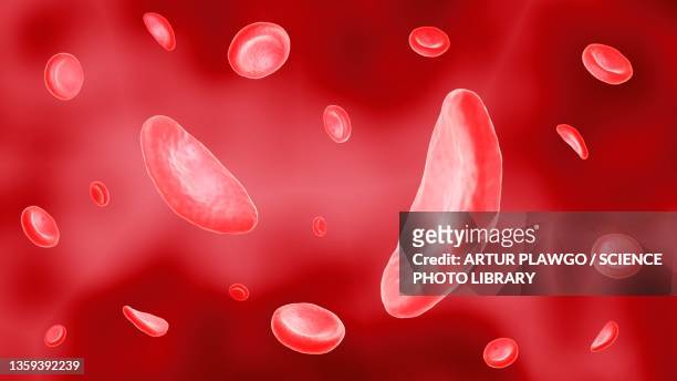 sickle cells, illustration - sickle cell stock illustrations