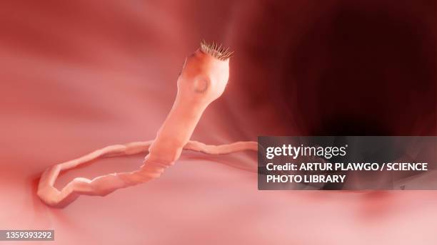 ilustraciones, imágenes clip art, dibujos animados e iconos de stock de tapeworm in the intestine, illustration - tapeworm