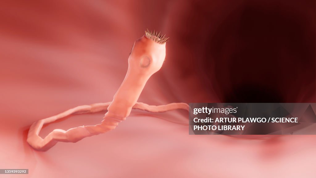 Tapeworm in the intestine, illustration
