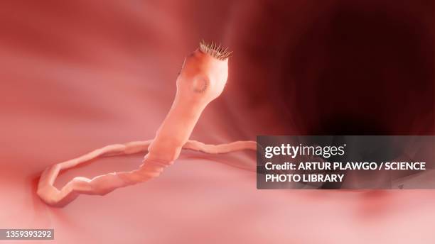 ilustrações, clipart, desenhos animados e ícones de tapeworm in the intestine, illustration - sistema digestivo animal