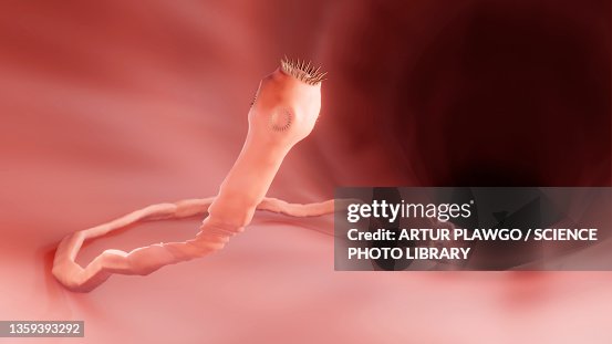 Tenia Intestinal Larvas De Tenia Solium