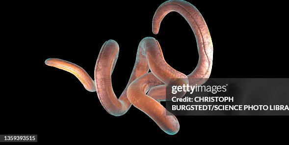 Threadworm, illustration Threadworm, illustration