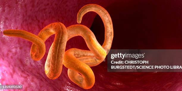 stockillustraties, clipart, cartoons en iconen met threadworm, illustration - nematode worm