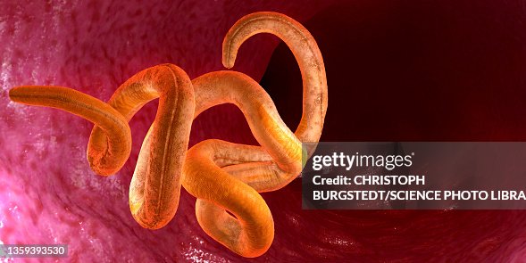 Threadworm Taxonomy Threadworm Illustration High-Res Vector Graphic - Getty Images