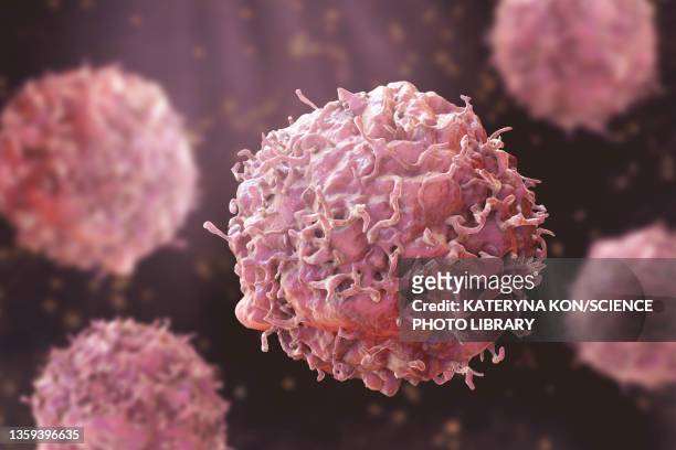 ilustraciones, imágenes clip art, dibujos animados e iconos de stock de cancer cells, illustration - tumor