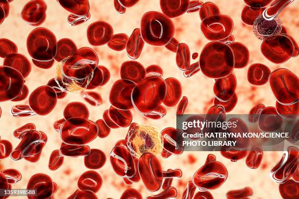 polycythemia vera, illustration - blut stock-grafiken, -clipart, -cartoons und -symbole