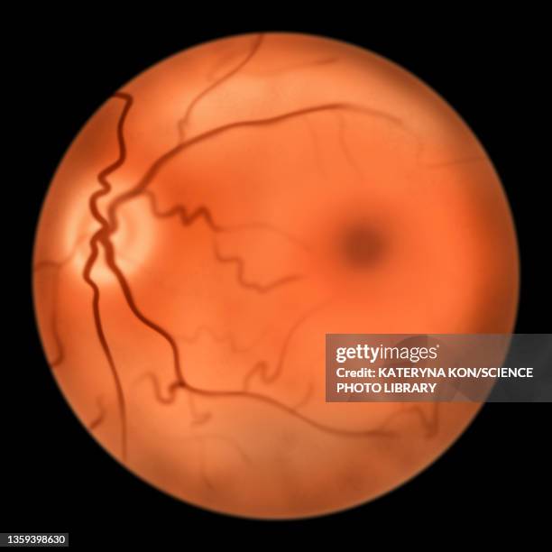 Normal Eye Dissection 59 Normal Anatomy Of The Eye Stock Photos, High-Res Pictures, and ...