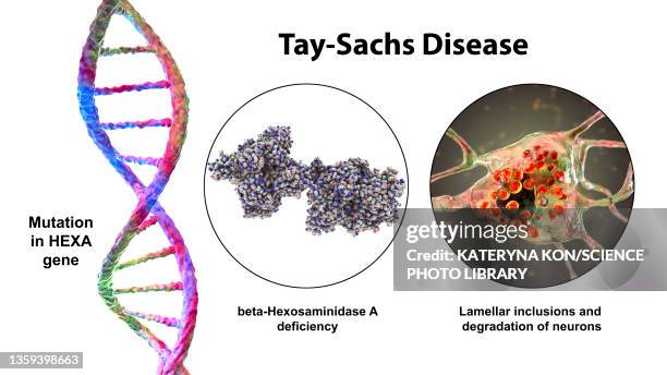 tay-sachs disease, 3d illustration - tay sachs stock-grafiken, -clipart, -cartoons und -symbole