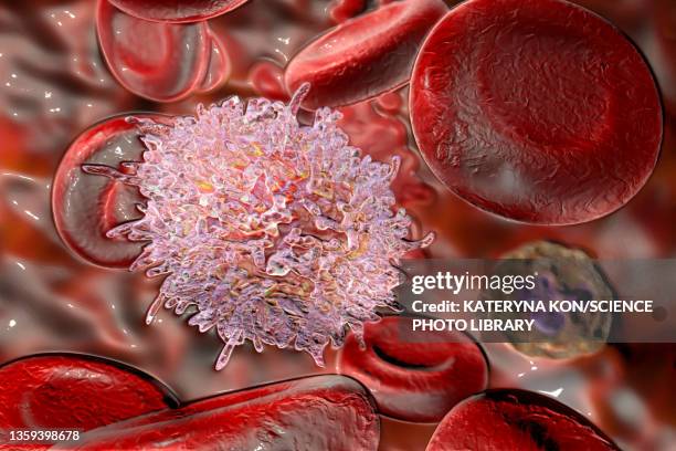 stockillustraties, clipart, cartoons en iconen met lymphocyte in hairy cell leukaemia, illustration - b cell