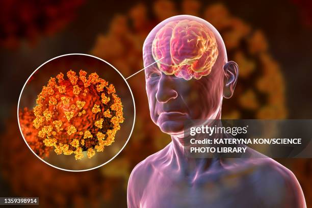 504点のalzheimer S Diseaseイラスト素材 Getty Images 504点のalzheimer S Diseaseイラスト素材 Getty Images