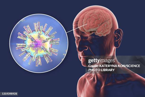 herpes viruses and dementia, conceptual artwork - herpes simplex virus stock illustrations