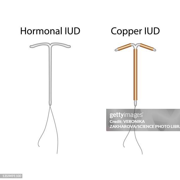Iud String Color Identification 76 Iud Illustration High Res Illustrations - Getty Images