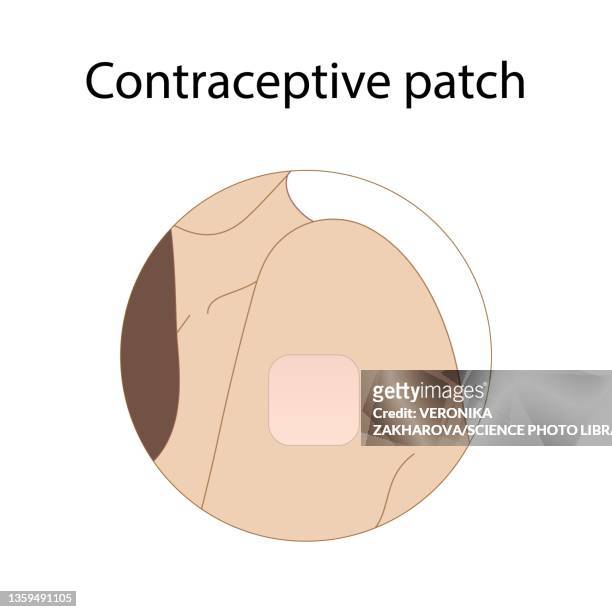 illustrazioni stock, clip art, cartoni animati e icone di tendenza di contraceptive patch, illustration - contraceptive patch