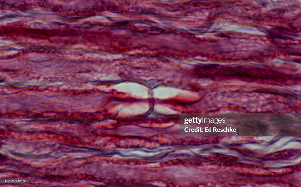NODE OF RANVIER--SPEEDS NERVE IMPULSE CONDUCTION, MYELINATED NERVE FIBERS IN A NERVE, LONGITUDINAL SECTION, 250X