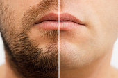 Close up photo of a man's face before and after shaving. a young man with a beard. Comparison of a man's face with a beard and without a beard. use of aftershave cream