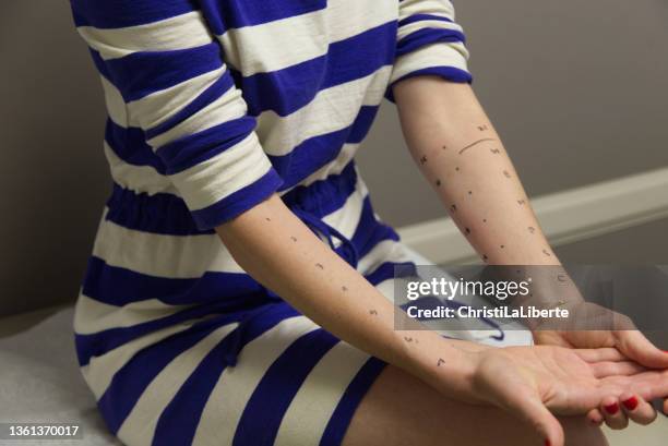 allergietest - allergietest stock-fotos und bilder