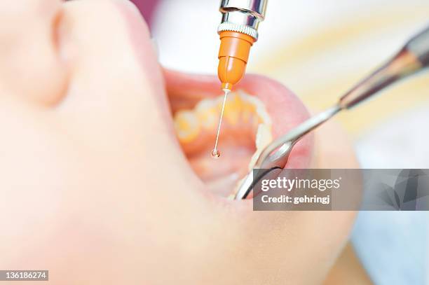 Denta Inj Dental Injection Photos and Premium High Res Pictures - Getty Images