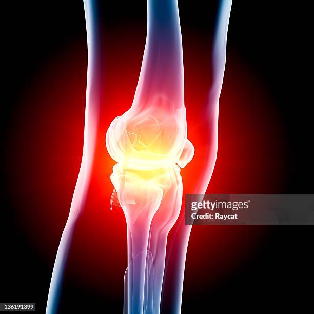 knee in pain x-ray - biomedical illustration stock pictures, royalty-free photos & images