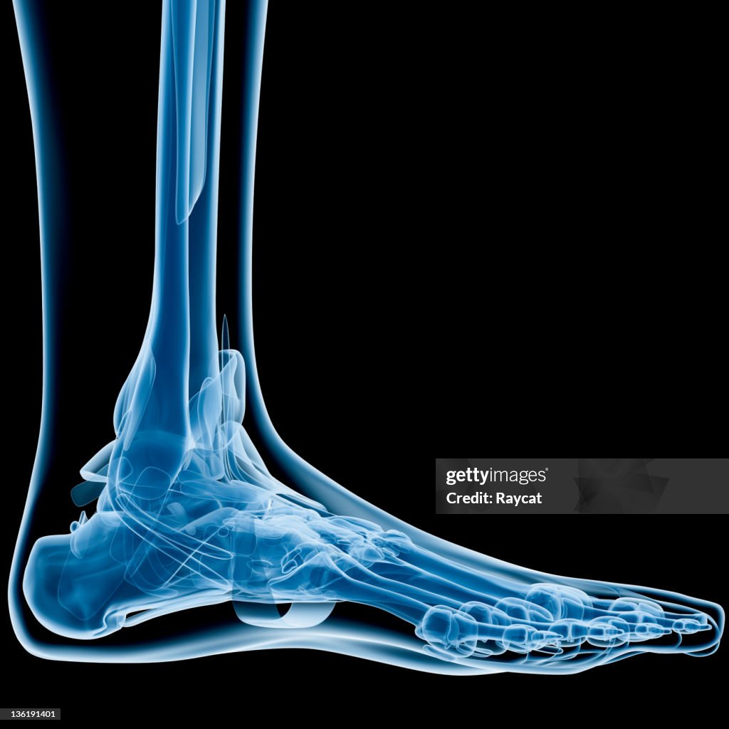 Große x-ray