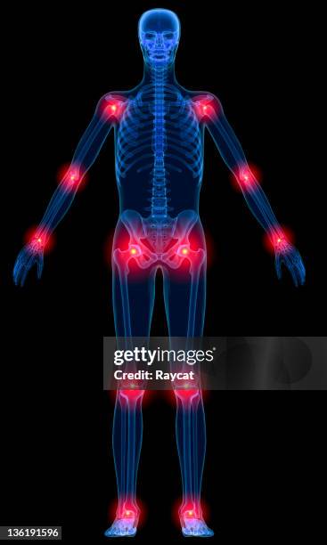 infiammazione delle articolazioni - giuntura foto e immagini stock
