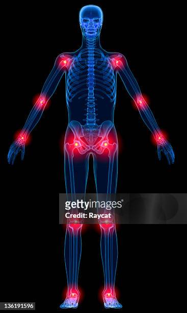 inflammation of joints - hip body part stock pictures, royalty-free photos & images