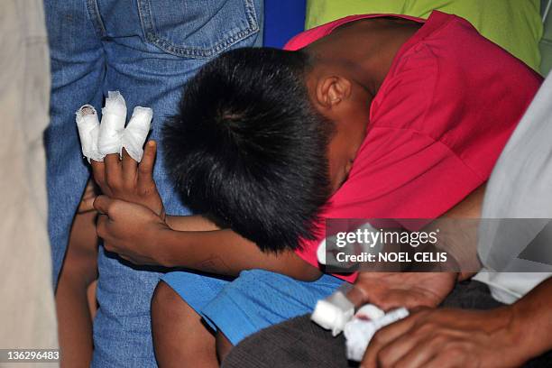 Firework Hand Damage 1,065 Fireworks Injuries Stock Photos, High-Res Pictures, and Images ...