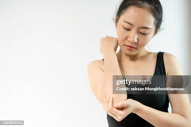 woman with pain in shoulder and upper arm , health care concept - touching elbows stock pictures, royalty-free photos & images