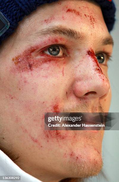 Tom Hilde of Norway looks on during a press conference prior the FIS Ski Jumping World Cup event at the 60th Four Hills ski jumping tournament at...