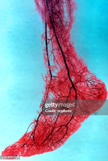 human foot arteries and veins - ateroskleros bildbanksfoton och bilder